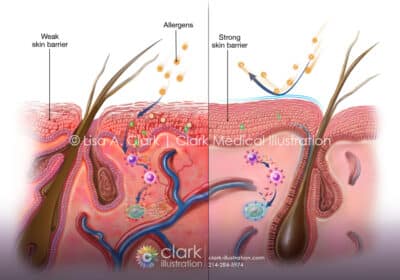 Canine Skin Allergies Barrier Illustration - Clark Medical Illustration Canine Skin Barrier Illustration