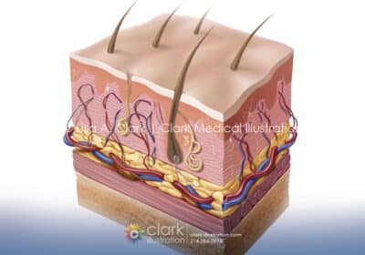 Skin Section Illustration - Clark Medical Illustration Skin Section Illustration